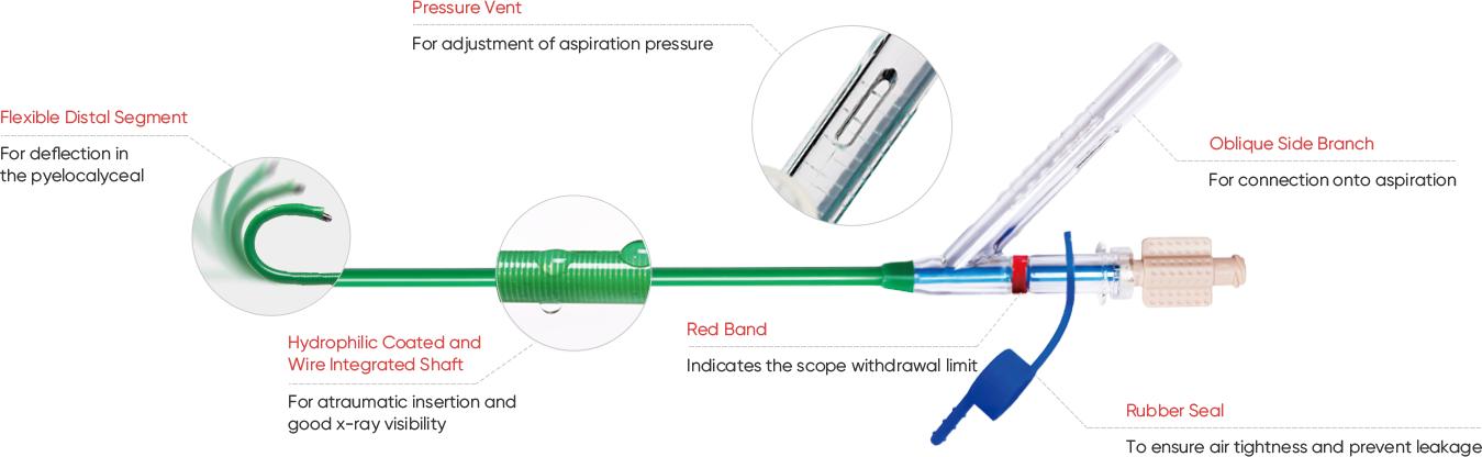 Unlocking Surgical Success with the ClearPetra Ureteral Access Sheath